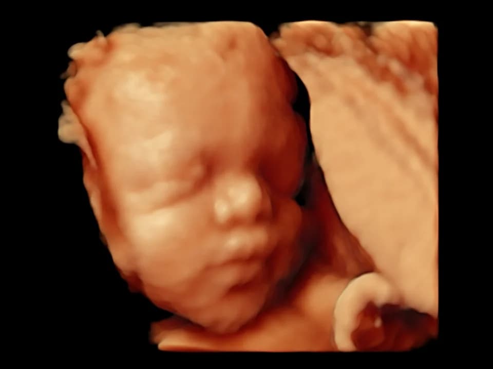 Illustrative amber ultrasound view of a face at an angle, with closed eyes and a curved shape beside the chin