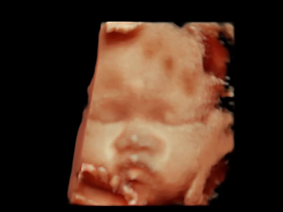 Illustrative amber ultrasound view of a face from the front, with closed eyes and soft contours around the mouth