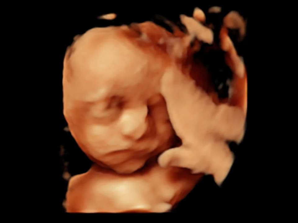 Illustrative amber ultrasound view of a tilted face, with part of the right side obscured