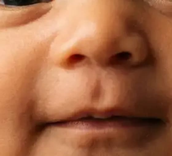 The same baby’s nose in the AI photo generated from the 28-week scan