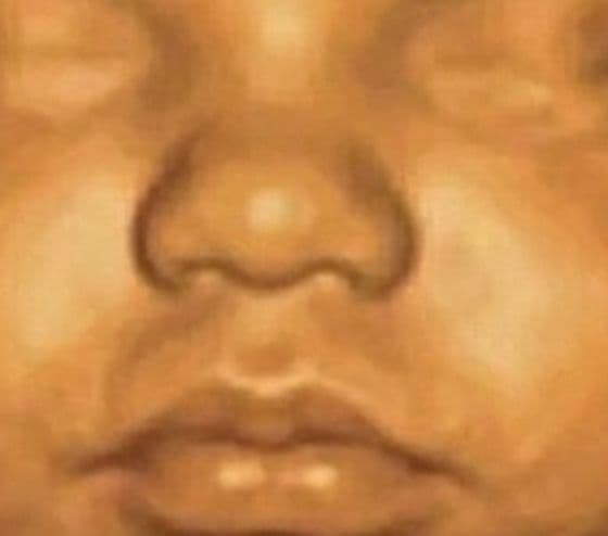 Close-up of a baby's nose on a 3D ultrasound at 28 weeks