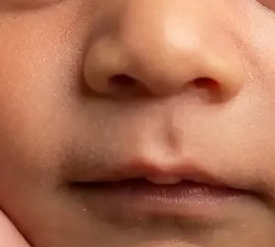 The same baby’s nose in the AI photo generated from the 32-week scan