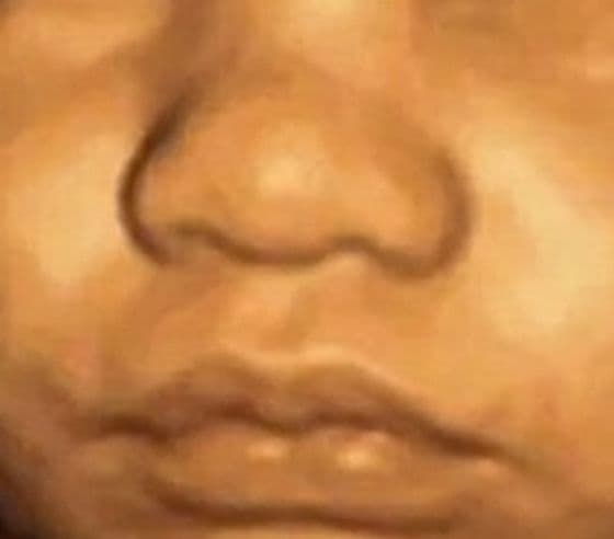 Close-up of a baby's nose on a 4D ultrasound at 32 weeks
