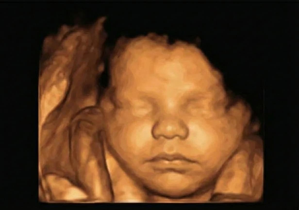 3D scan ultrasound Week 30