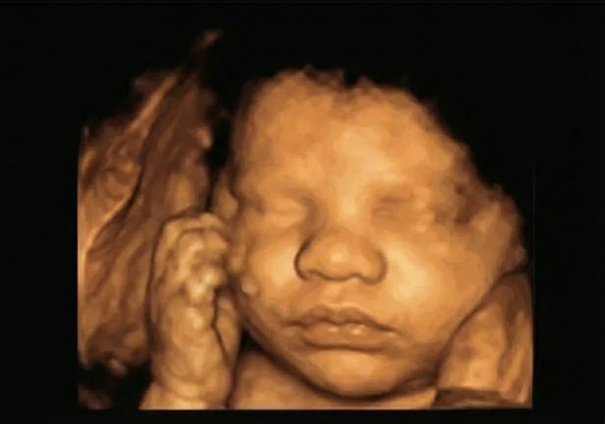 4D scan ultrasound Week 32